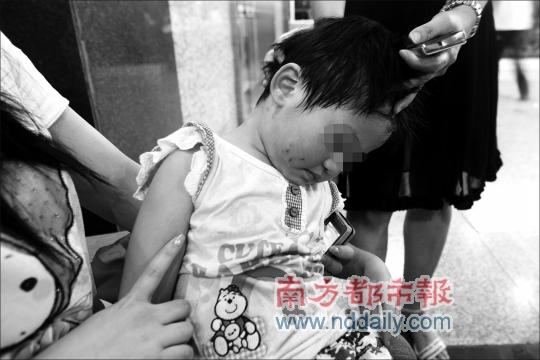家长撒野幼儿园内抓伤女童下体 为女儿复仇-